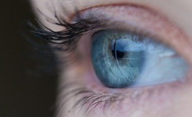 皮膚のたるみが主体の眼瞼下垂の治療