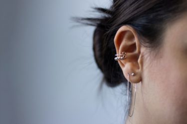耳垂裂：ピアスで耳たぶが裂けたら治せる？
